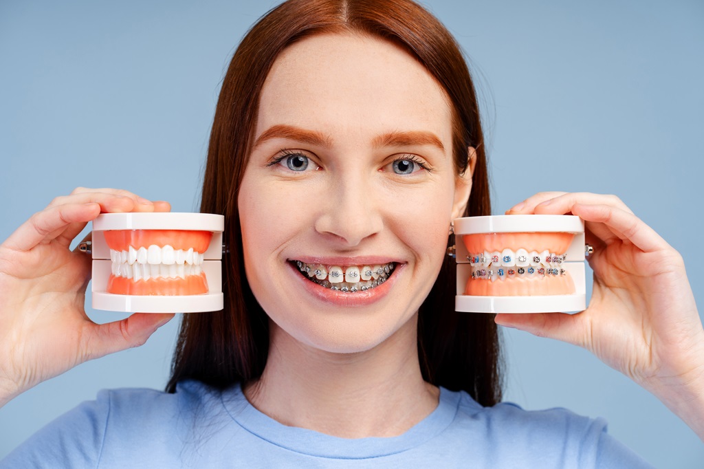 Ginger smiling woman with braces in blue shirt holding jaw models with braces and without isolated