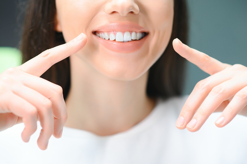 Beautiful Smile. Closeup Portrait Of Beautiful Happy Young Woman With Perfect White Teeth