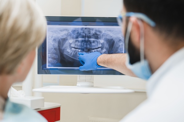 Back view shot of male dentist orthodontist showing explaining an x-ray photo of impacted wisdom tooth
