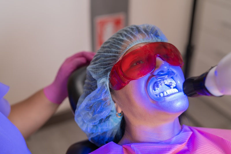 Dentists doing teeth whitening procedure to a female patient